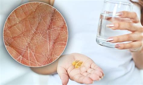 best vitamin for eczema|What Are The Best Vitamins & Supplements .